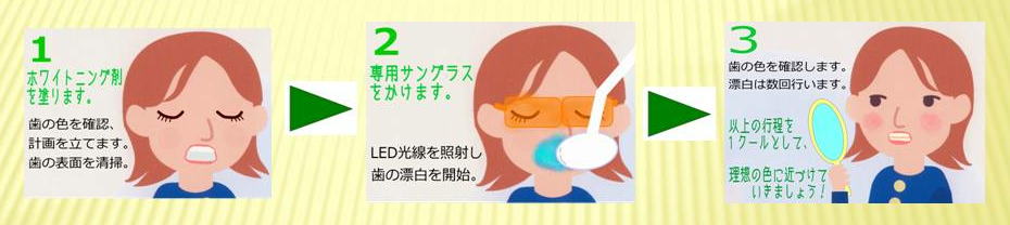 ���� ���ނ玕�� �� �I�t�B�X�z���C�g�j���O �̗���
