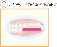 ���ݍ��킹�̈ʒu�����߂܂�