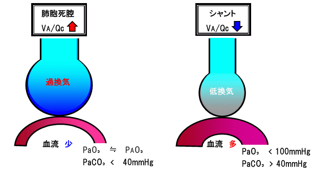 換気−血流比