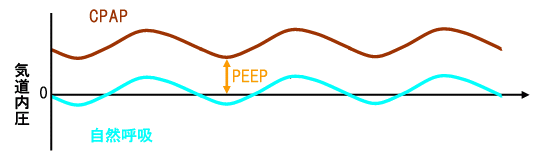 CPAP (Cz)