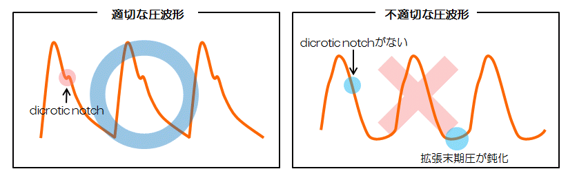 Equalize(normalize)�ɓK�؂Ȉ��g�`�ƕs�K�؂Ȉ��g�`