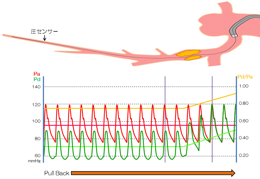 ����������(pullback)