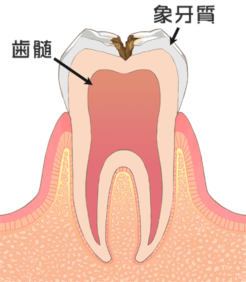 C2