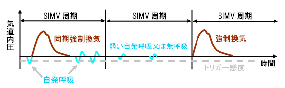 人工呼吸器のモードと波形 臨床工学技士国家試験対策ノート