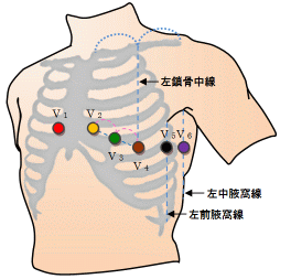 胸部誘導電極位置