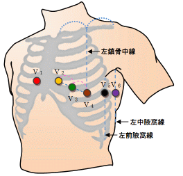 付け方 心電図 の 心電図読み方｜基本を理解するための１０のポイント｜医学的見地から
