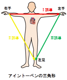 アイン トーベン の 三角形