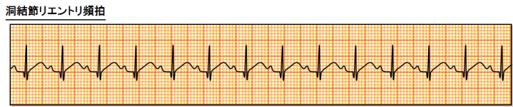 ߃Ggp(SANRT)