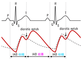 IABP̖cƎk̃^C~O