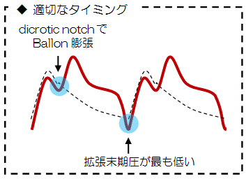 K؂IABP̃^C~O