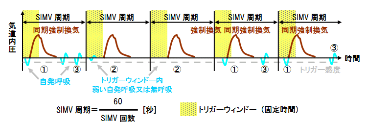 Simv 同期式間欠的強制換気