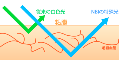 NBIイメージ