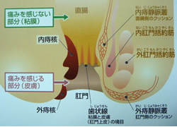 bui