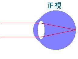 正視