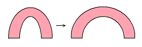 歯列弓の変化