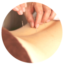 鍼灸で何が治る?