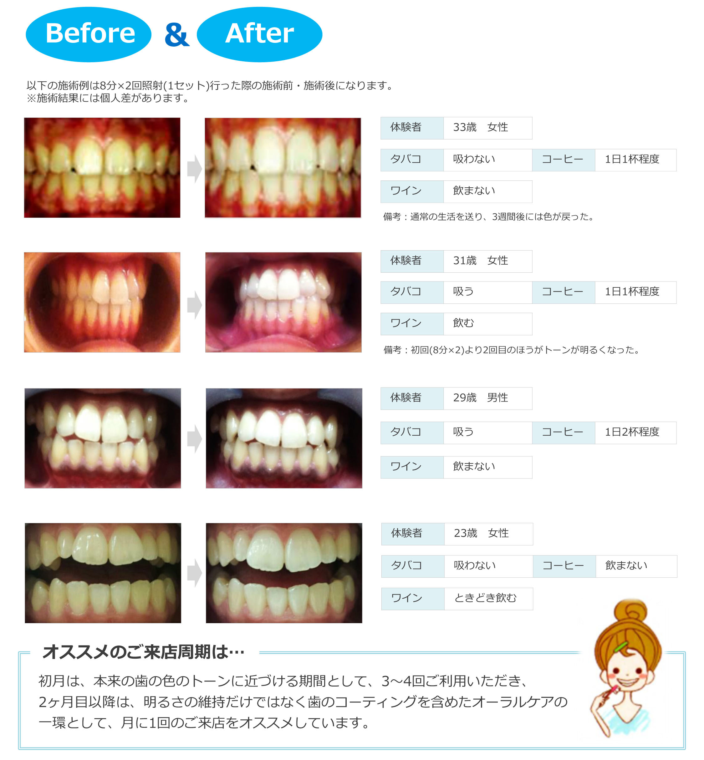 ホワイトニング　結果