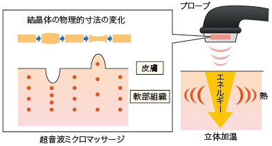 超音波診断器