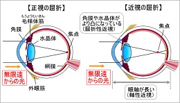 イラスト4