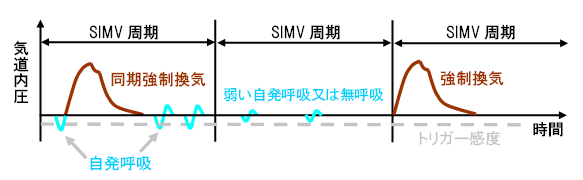 SIMV (ԌIC)