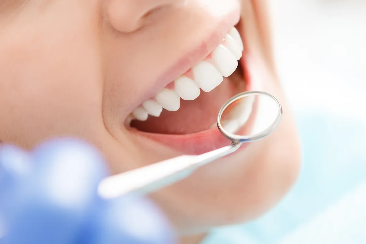 予防歯科イメージ画像