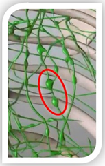 リンパ節｜BE SEITAI　817パシフィカ堺