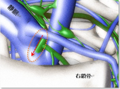 鎖骨リンパ本管｜BE SEITAI　817パシフィカ堺