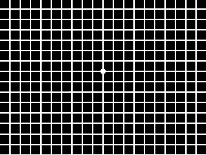 黄斑変性症は遺伝するのでしょうか？